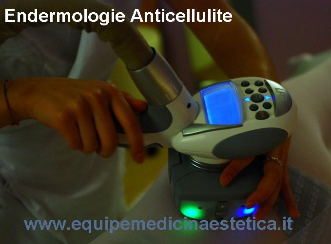 Trattamenti cellulite - Endermologie